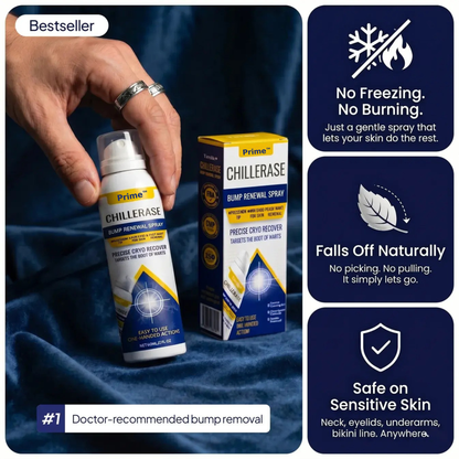 Chillerase Bump Renewal Spray: Safe, Fast Cryotherapy Wart Removal At Home