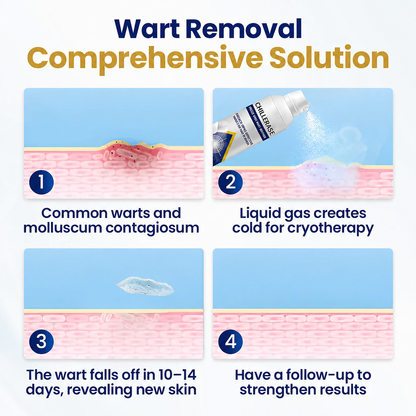 Chillerase Bump Renewal Spray: Safe, Fast Cryotherapy Wart Removal At Home