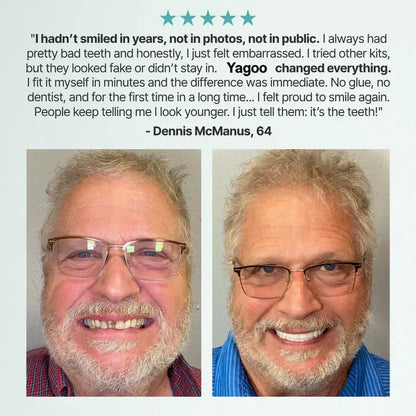 ⏰Ends Today: 40% OFF! 🌎KLENIMORE™ Custom-Fit  Dentures— Designed for Comfort and a Natural-Looking Smile
