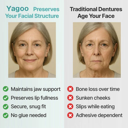 ⏰Ends Today: 40% OFF! 🌎KLENIMORE™ Custom-Fit  Dentures— Designed for Comfort and a Natural-Looking Smile