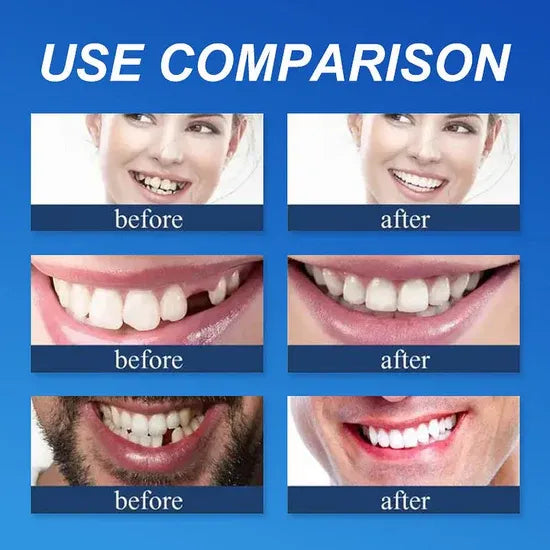⏰Ends Today: 40% OFF! 🌎KLENIMORE™ Custom-Fit  Dentures— Designed for Comfort and a Natural-Looking Smile